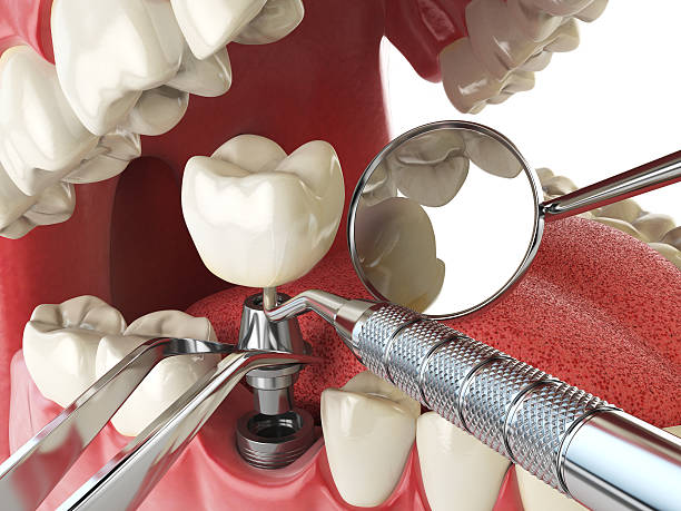 Best Emergency Dentist for Knocked-Out Tooth in Woodward, OK